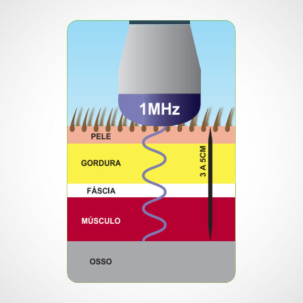 Imagem de gráfico mostrando a tecnologia do Sollievo